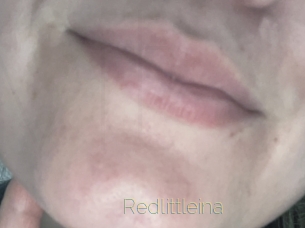 Redlittleina